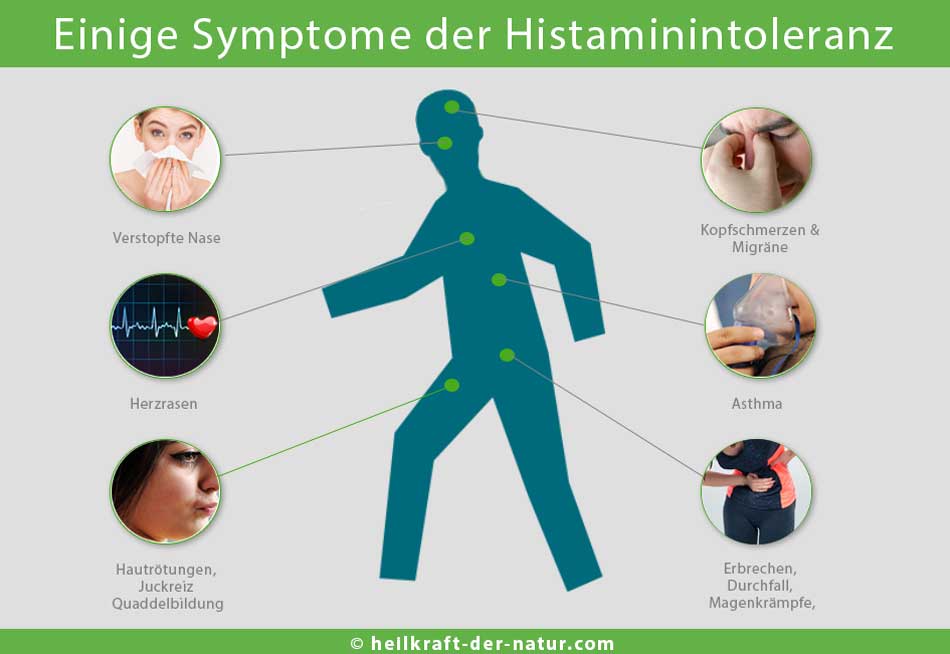 Symptome einer Histaminintolleranz