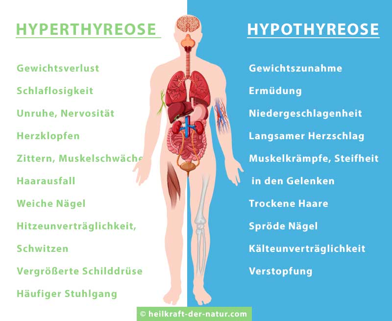 hypothyreose hyperthyreose schilddrüse